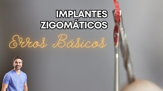 Implantes Zigomáticos  Erros Básicos [upl. by Alor]