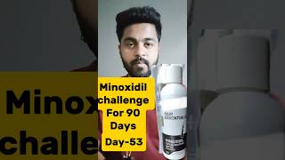 Minoxidil challenge For 90 DaysDay53minoxidil haircare viralreels viralshorts trendingshorts [upl. by Jacinthe]