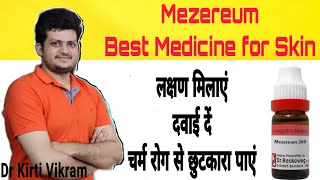 किस्सा क्लीनिक का  Mezereum  Kye Symptom  Fungal Infections  Eczema  Seborrheic dermatitis [upl. by Esbenshade]