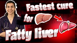 What is the fastest way to cure a fatty liver [upl. by Marlin166]