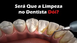 Como é Feita a Limpeza no Dentista  Remoção De Tártaro [upl. by Hsac]