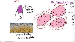 Systemic pathology 13  respiratory system 1  pneumonia and lung abscess DRSAMEH GHAZY [upl. by Nnayrb]