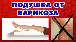 Ортопедическая подушка от варикоза отеков усталости ног  Подушка для профилактики варикоза [upl. by Yetac]