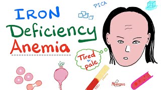 Iron Deficiency Anemia  All you need to know  Causes Symptoms Diagnosis Treatment [upl. by Laurens]