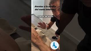 Lesiones de Rodilla Clave del Vasto Interno en la Recuperación y Prevención fyp viral parati [upl. by Nomis81]