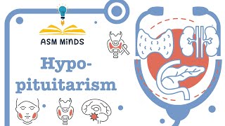 HypoPituitarism by ASM Minds [upl. by Munt354]