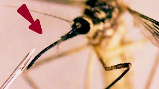 A closer look at Mosquito under the microscope Zoomphilic [upl. by Amberly820]