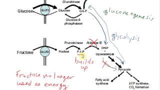 Hereditary Fructose Intolerance HFI [upl. by Sokem865]