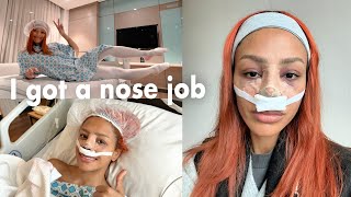 I got a NOSE JOB IN TURKEY What to expect surgery day bag prep pain cost why I did it pt 1 [upl. by Fattal]