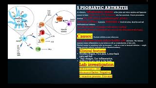 DIFFERENTIAL DIAGNOSIS AND MANAGMENT OF MONOARTHERITIS [upl. by Hirst481]