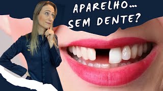 Como colocar aparelho sem dente🧐 aparelhoautoligado dentista aparelho autoligado [upl. by Richmond]