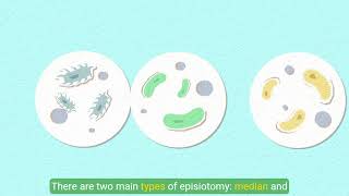 Understanding Episiotomy [upl. by Nilrem901]