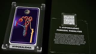 Hypokalemia [upl. by Syl]