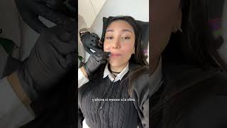 Mejorando mis labios con ácido hialuronico fillers [upl. by Ryley657]