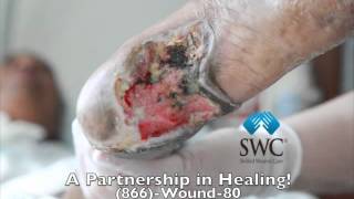 Heel Vascular Wound Healing Morph [upl. by Nairim270]