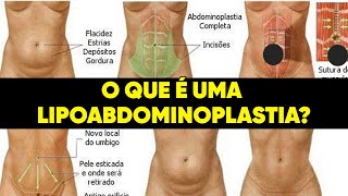 O QUE É UMA LIPOABDOMINOPLASTIA [upl. by Enrica]