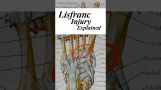 🚨 Understanding DeMarcus Lawrences Lisfranc Injury✨ [upl. by Whetstone]