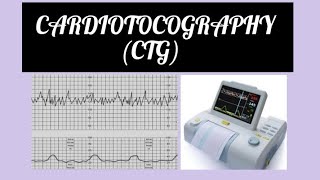 Cardiotocography CTG INTERPRETATION gynaecology obstetrician labour ctg [upl. by Jonette620]