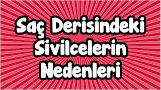 Saç Derisindeki Sivilcelerin Nedenleri [upl. by Hester]