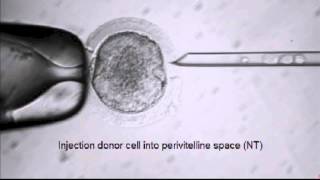 Stem Cell Breakthrough Summarized by OHSUs Dr Shoukhrat Mitalipov [upl. by Ikeda]