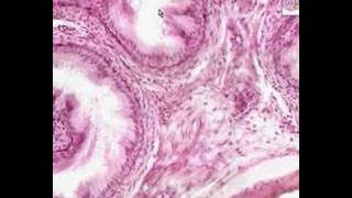 Shotgun Histology Epididymis [upl. by Aiem170]