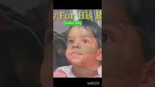 Cerebral Palsy  Kids Disease  Baby Illness babyvideo trending [upl. by Scrivens672]