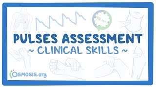 Clinical Skills Pulses assessment [upl. by Yltnerb]