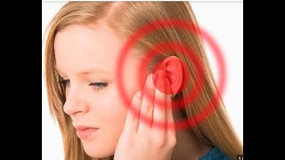 Imaging of Pulsatile Tinnitus [upl. by Hcib]