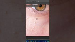 Comment enlever des boutons photoshop tuto [upl. by Ayhtak]