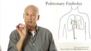 Chest Pain 1 Schema [upl. by Yamauchi]