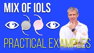 Mixing IOLs for better vision outcomes  practical examples [upl. by Duarte176]