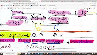 NEUROOPTHALMOLOGY PART I  OPTHALMOLOGY  5TH YEAR [upl. by Ahcsrop]