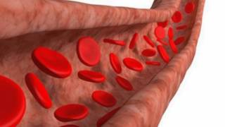 Difference Between Arteriosclerosis and Atherosclerosis [upl. by Bellanca]