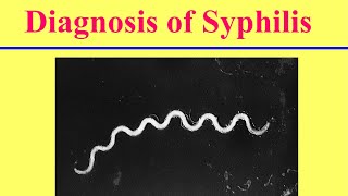 التشخيص المعملى لمرض الزهري ‏Lab Diagnosis of Syphilis [upl. by Seppala524]