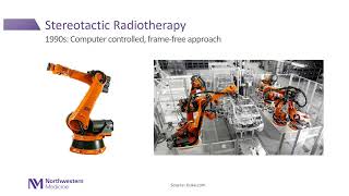 Stereotactic Radiotherapy SABRSBRT for Prostate Cancer Present and Future [upl. by Lebiram166]