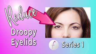 How to Fix Droopy Eyelids INSTANTLY [upl. by Ramey]