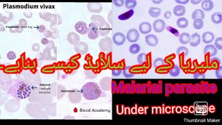 MALARIAL parasite Examination Under Microscope [upl. by Pas]