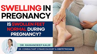 Swelling in Pregnancy  Swollen legs amp Feet  Whats Normal amp When to Worry  Healing Hospital [upl. by Lamrouex206]