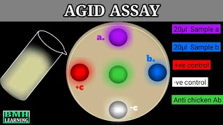 Agar Gel Immunodiffusion Assay  AGID Assay [upl. by Malorie858]