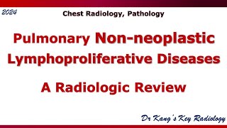 Pulmonary Nonneoplastic lymphoproliferative disease LPD [upl. by Rosner]