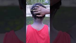 Neck Cleaning Tips  Dark Neck Remove Home RemediesGet Rid Of Dark Neck dark shorts viralvideo [upl. by Oiruam306]