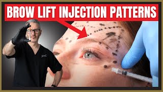 Botox Brow Lift Injection Patterns Botox MarkUp Tutorial [upl. by Schreibe]