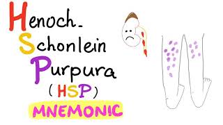 HenochSchönlein Purpura HSP  with a Mnemonic [upl. by Pate670]