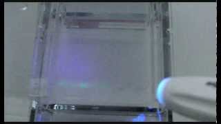 Agarose gel electrophoresis of proteins [upl. by Aivartal]