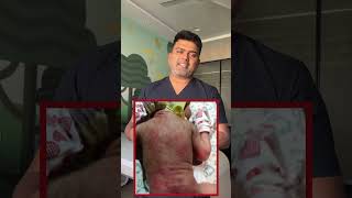 Rashes in baby  is it dangerous mommyexpertise newbornbaby doctor babyexpert baby funny mom [upl. by Noryb]