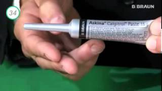 Askina® Calgitrol® Apósito estéril para el cuidado de heridas [upl. by Arlen959]