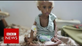 Yemen On the brink of starvation  BBC News [upl. by Pattin655]