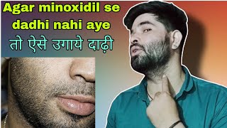 Agar minoxidil se bhi beard nahi aye toh kya kare  beard hair transplant kaise karaye [upl. by Silletram956]