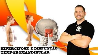 Hipercifose e Disfunção Temporomandibular  Canal do Personal [upl. by Nostets]