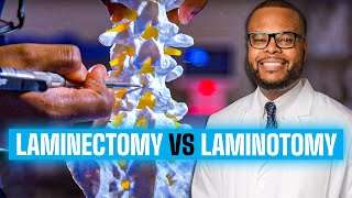 Laminectomy vs Laminotomy  Spinal Decompression Explained [upl. by Akinirt]